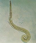 蛲虫(Enterobius vermicularis)